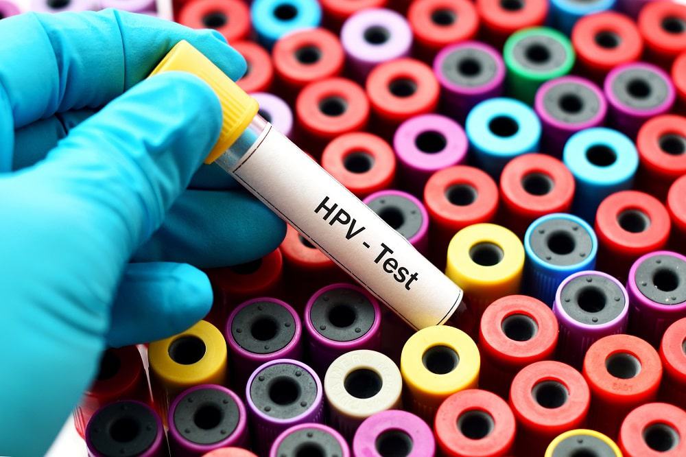 teste-HPV