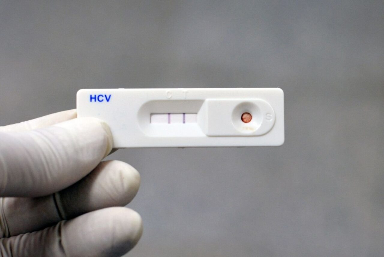 exame-anti-hcv-point-of-care